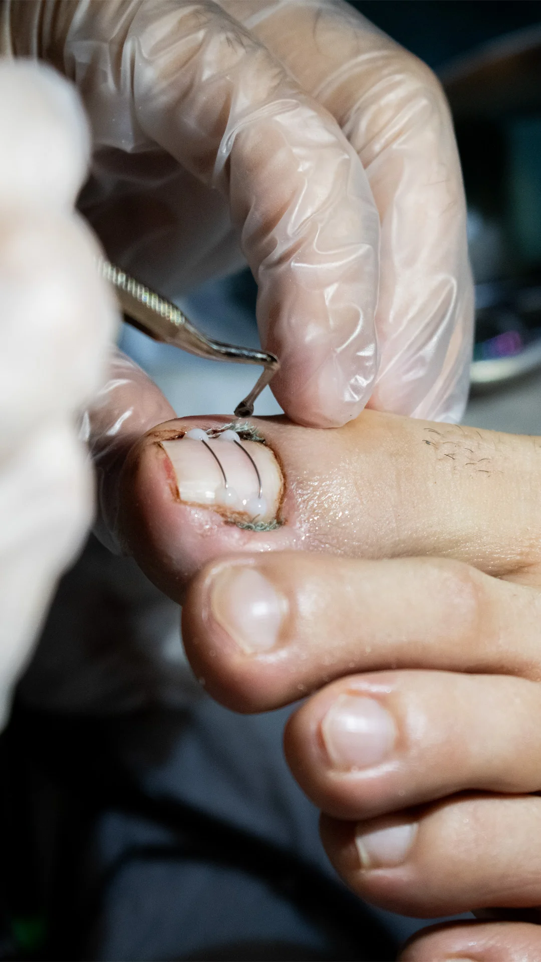 Thumbnail پودولوژی