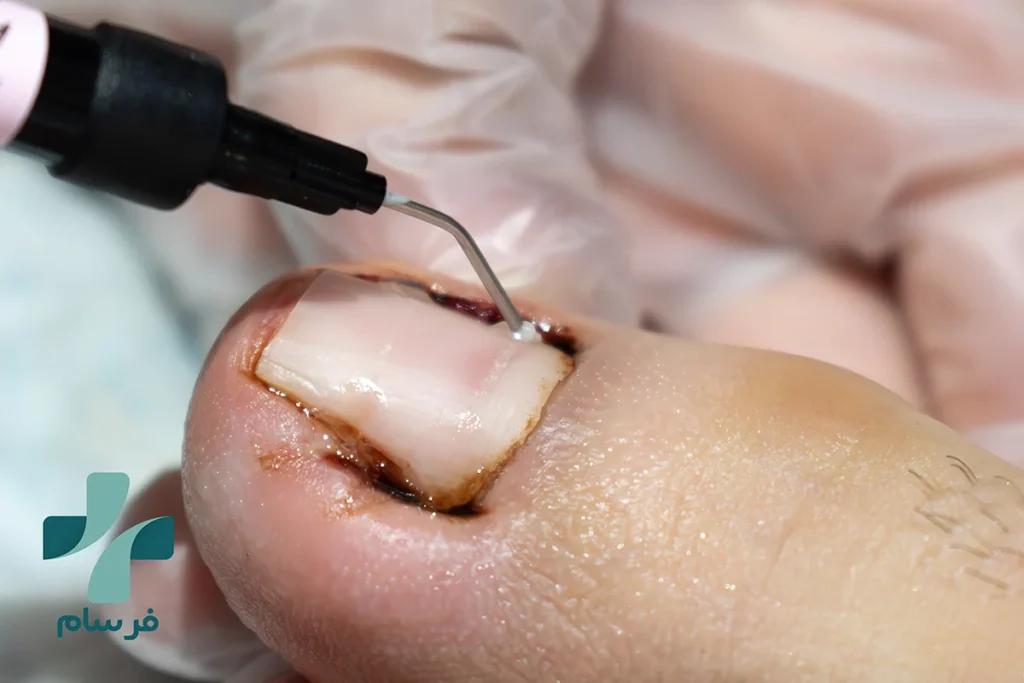 پودولوژی در کرج