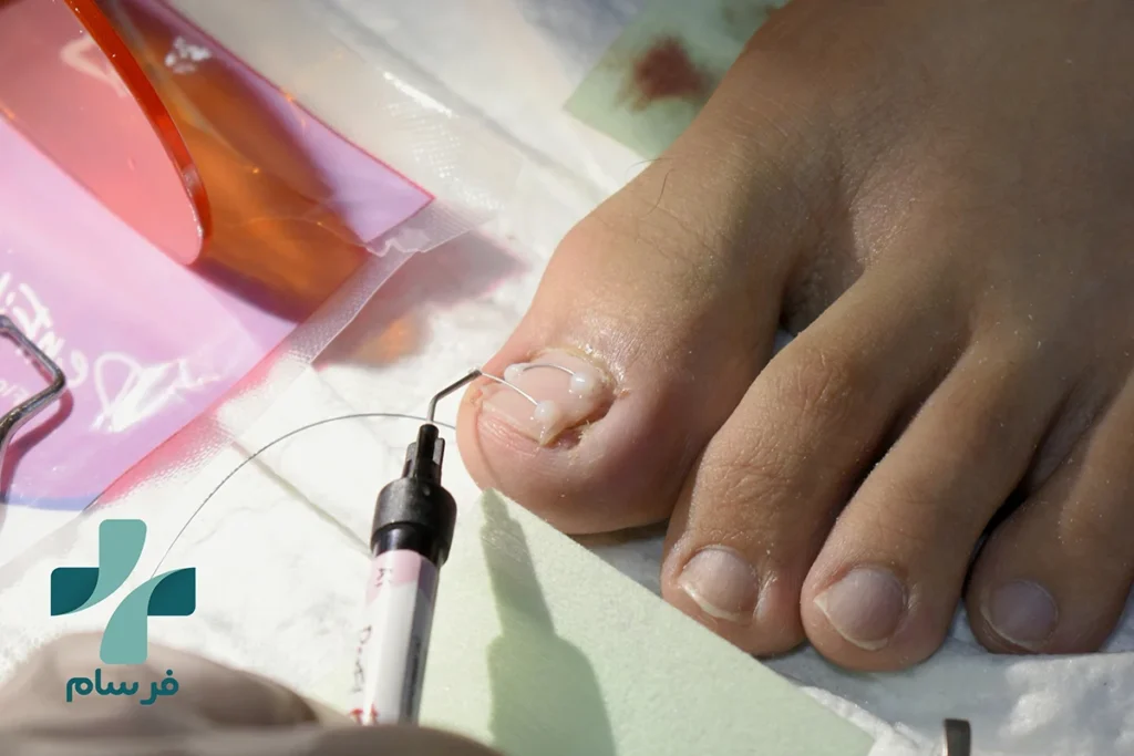 ارتونیل کرج