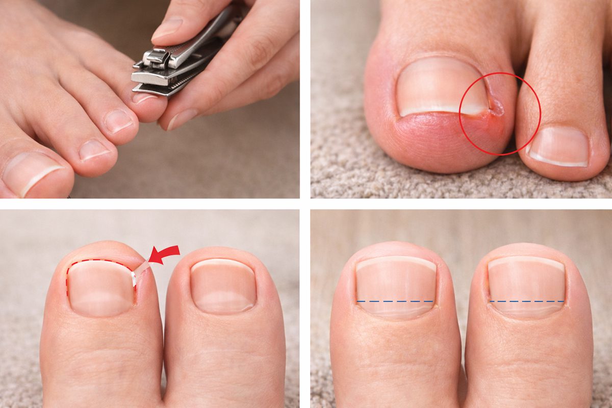 اشتباهات شایع در کوتاه کردن ناخن